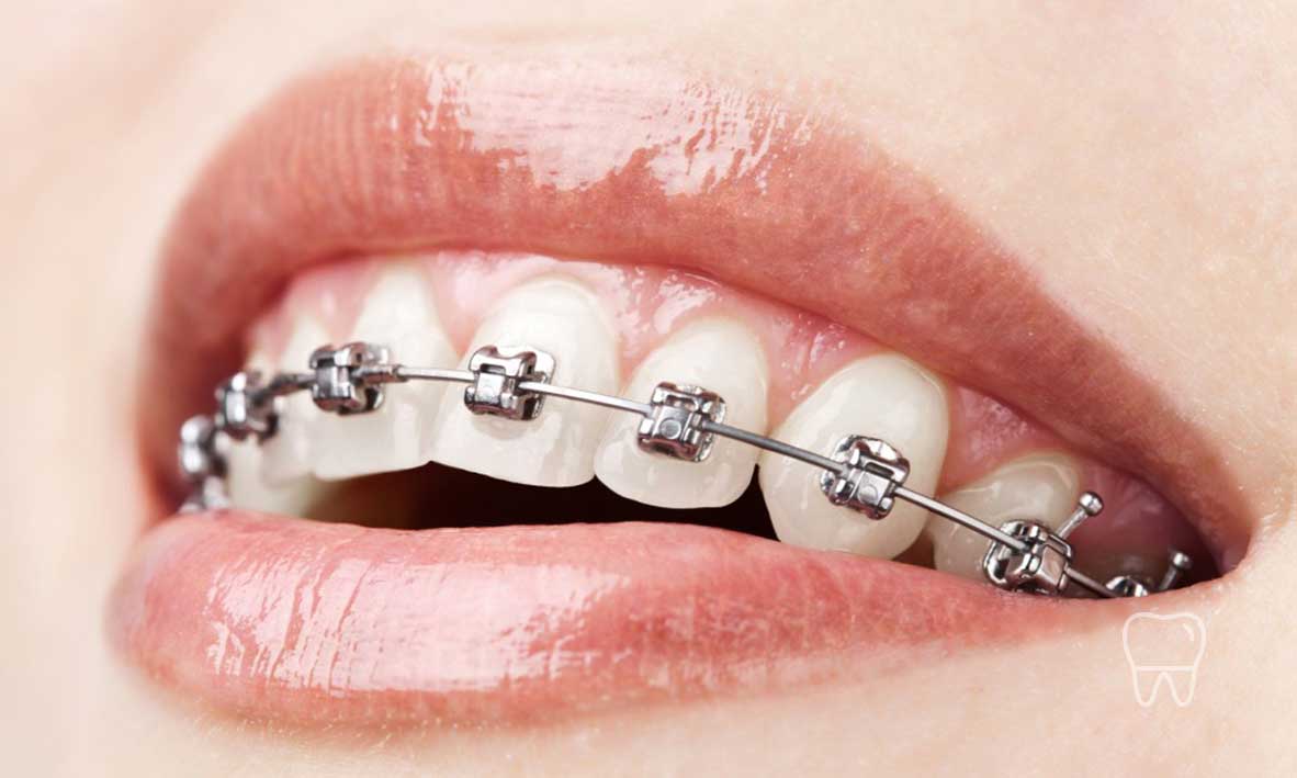 Orthodontics